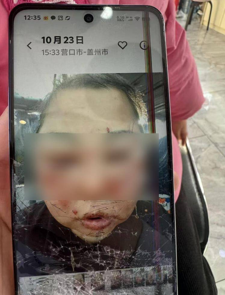 立陶宛vs德国_被前夫打进ICU的女子不幸身亡立陶宛vs德国，大女儿称正送母亲去殡仪馆，今后安排暂未考虑，希望严惩凶手